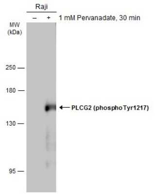 Western Blot: PLC-gamma 2 [p Tyr1217] Antibody [NBP3-13270]